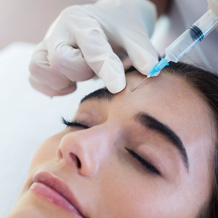 Photo Facial