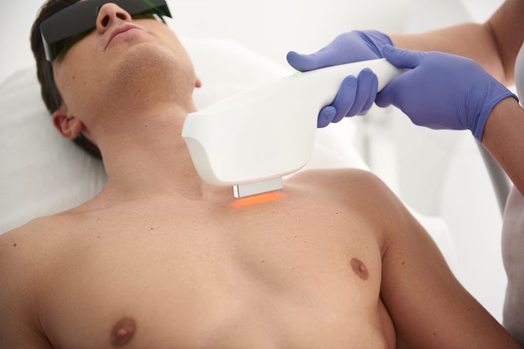 Photo Facial