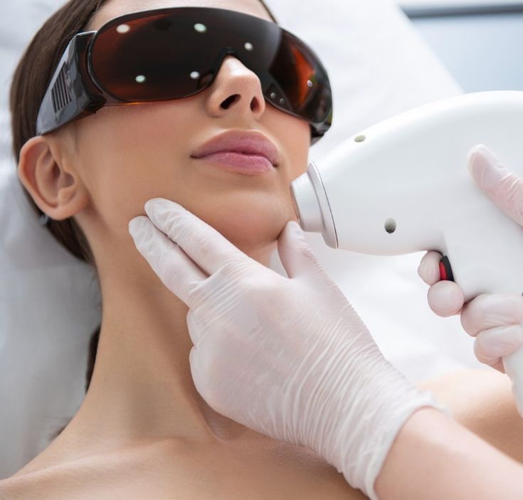 Photo Facial
