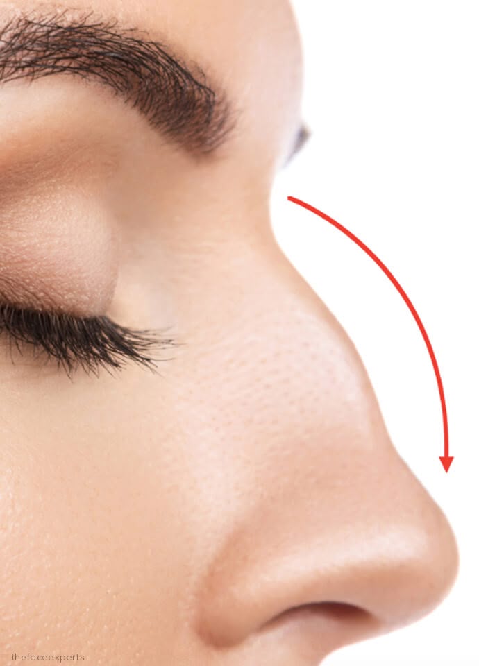 Photo Facial